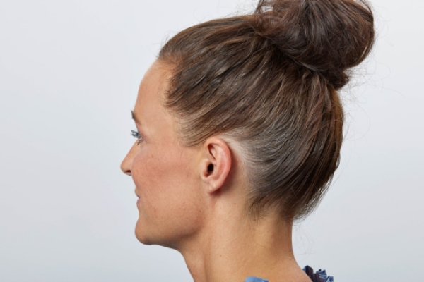 ITE hearing aids ear coverage